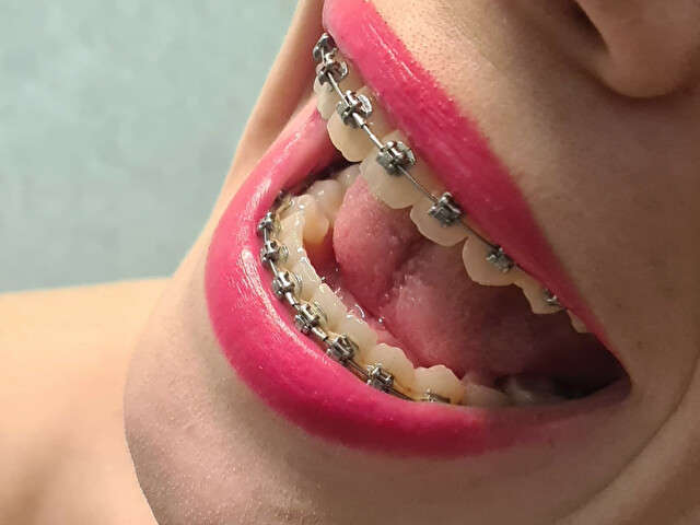 LONELYFLOWER amateur webcam photo